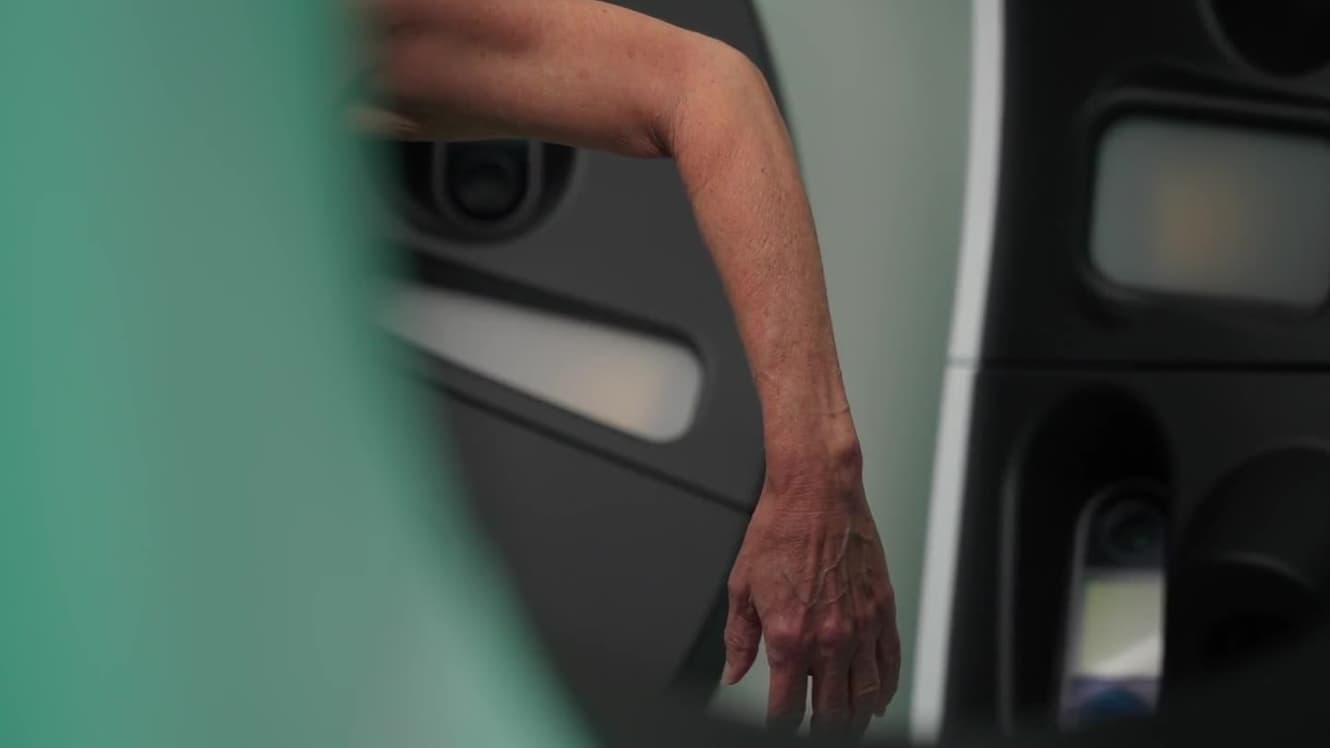 A patient's visit at SpotDoc Brownwood: total body photography with the Vectra WB360, then a same-day review of the images with the care team