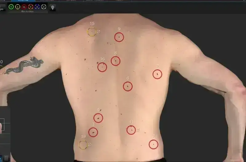 360-degree skin imaging