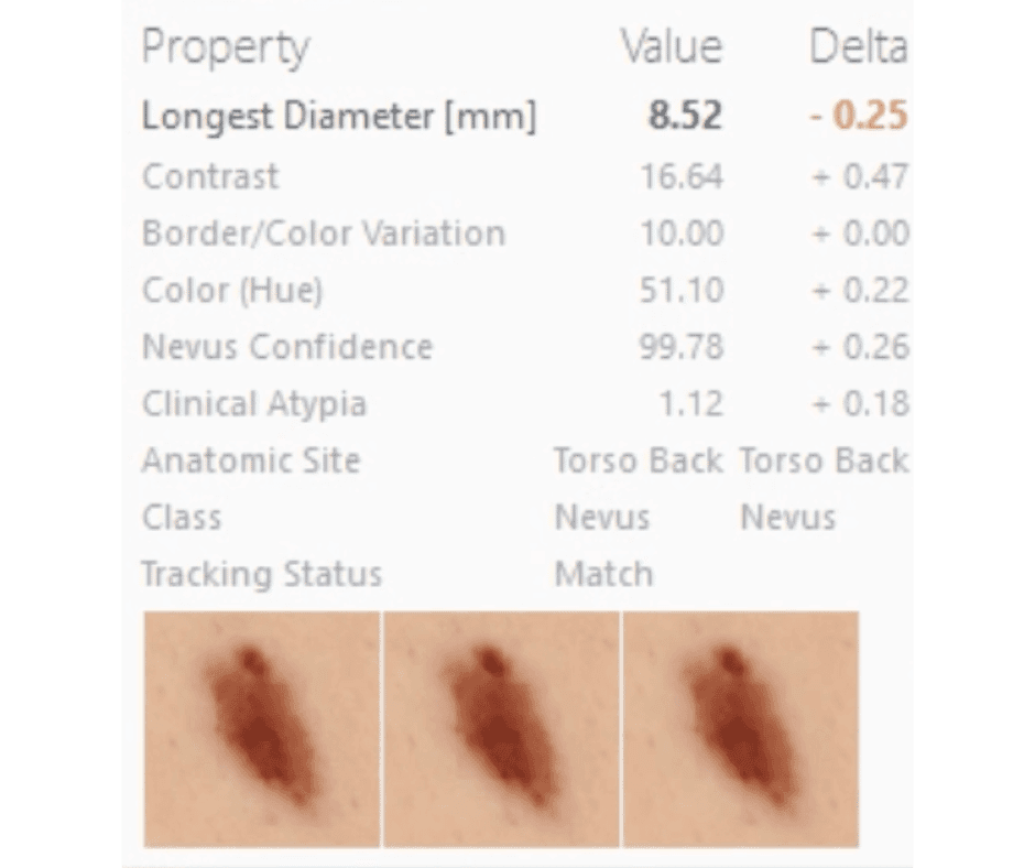 AI feature extraction