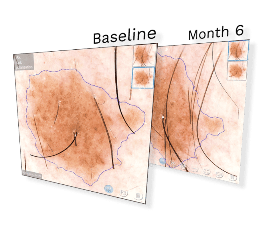 Reduced unnecessary biopsies