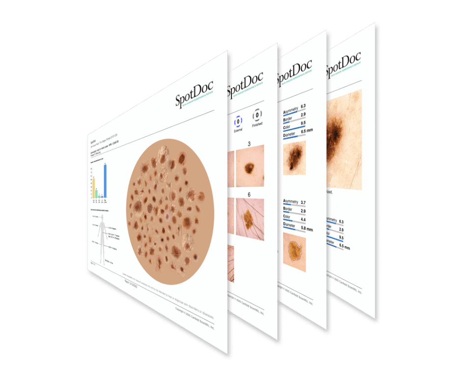 Personalized skin care monitoring