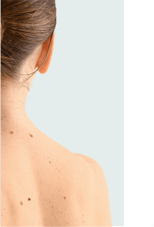 Patient getting skin check