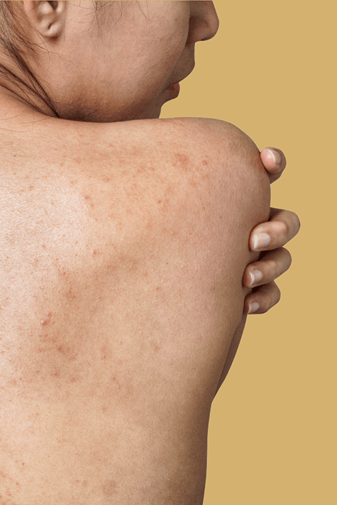 Patient getting skin check