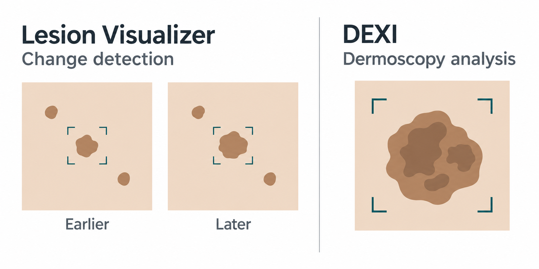 Lesion Visualizer panel compares a spot in earlier and later images; a separate DEXI panel illustrates close-up dermoscopic image analysis